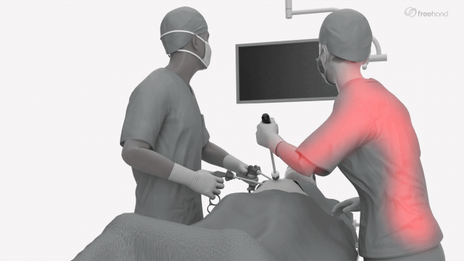 4-ergonomics.png Surgeon and assistant operating with discomfort shown in red